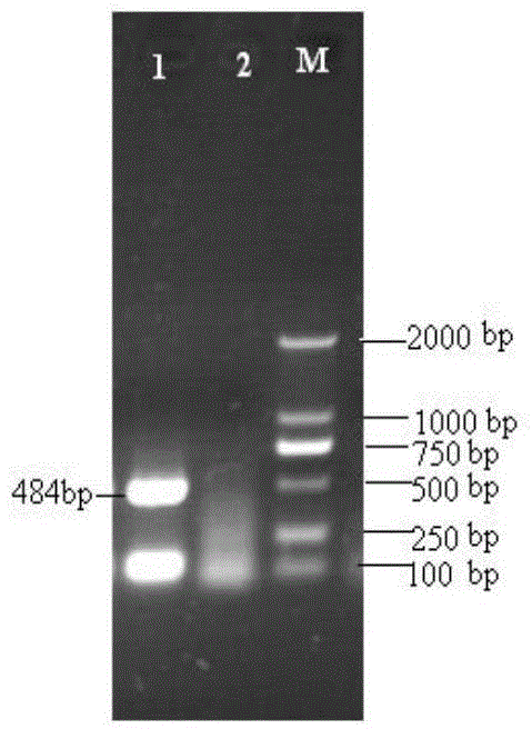 Anti-swine transmissible gastroenteritis virus and porcine epidemic diarrhea virus egg-yolk antibody and preparation method thereof