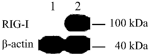 NF-kappa B dual-luciferase reporter cell capable of stably expressing pig-origin RIG-I receptor genes and construction method thereof