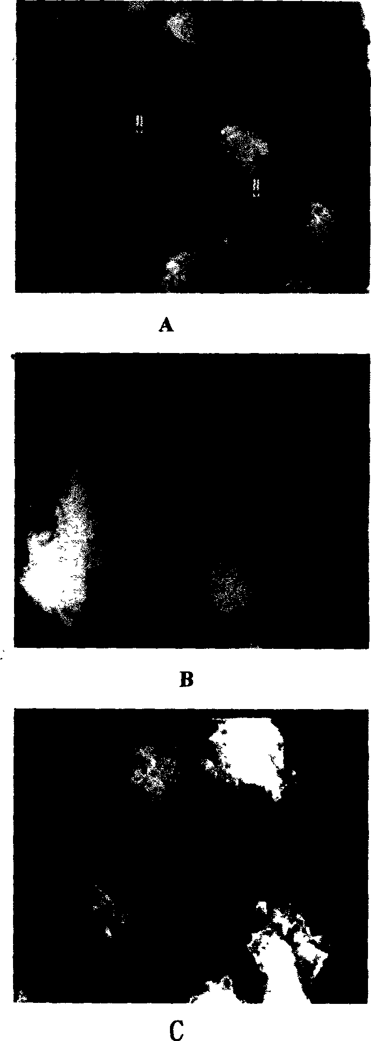 Location controlled releasing method for ultrasonic microbubble contrast medium