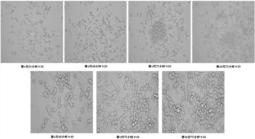 Establishment and applications of human pituitary adenoma cell line