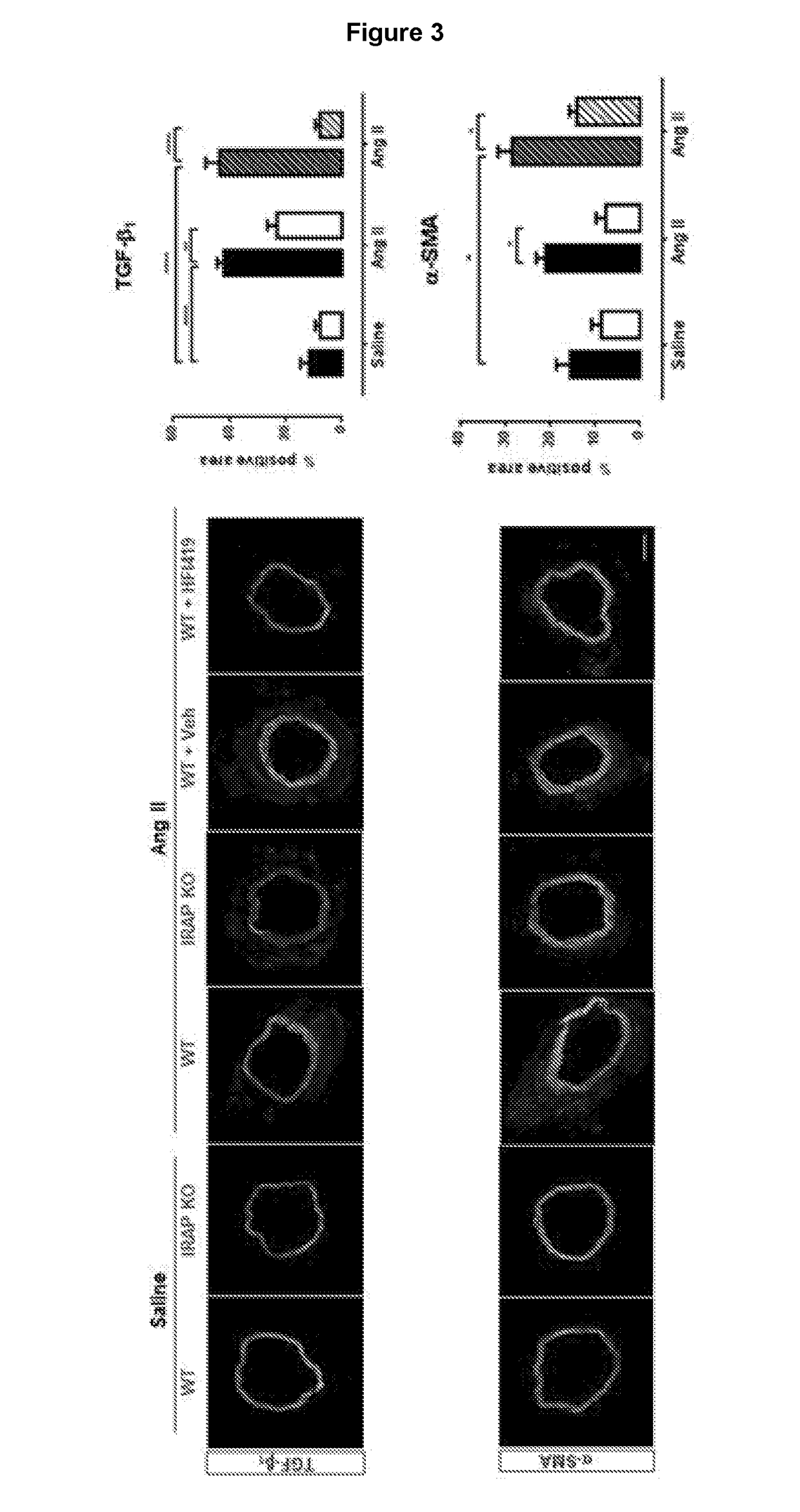 Fibrotic treatment