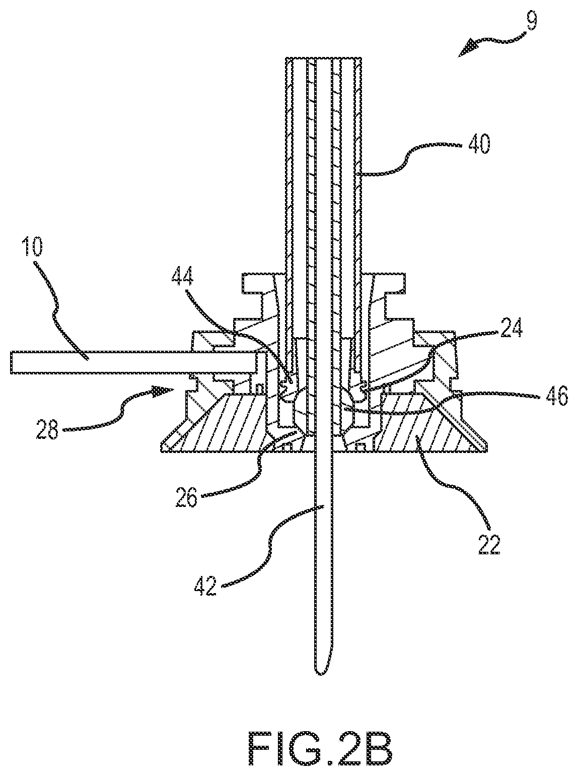 Cardiac tissue anchoring devices, methods, and systems for treatment of congestive heart failure and other conditions