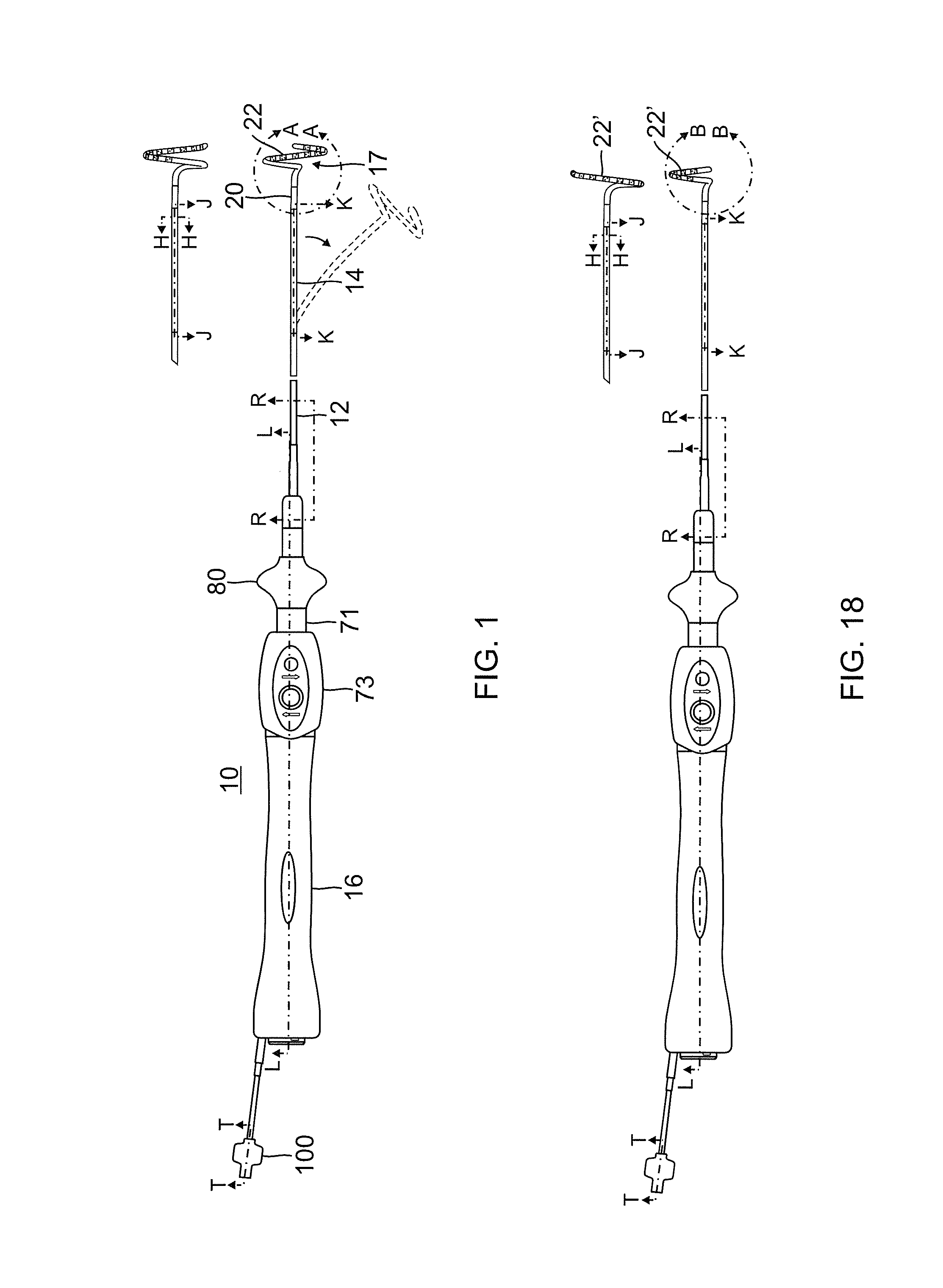 Catheter with variable arcuate distal section