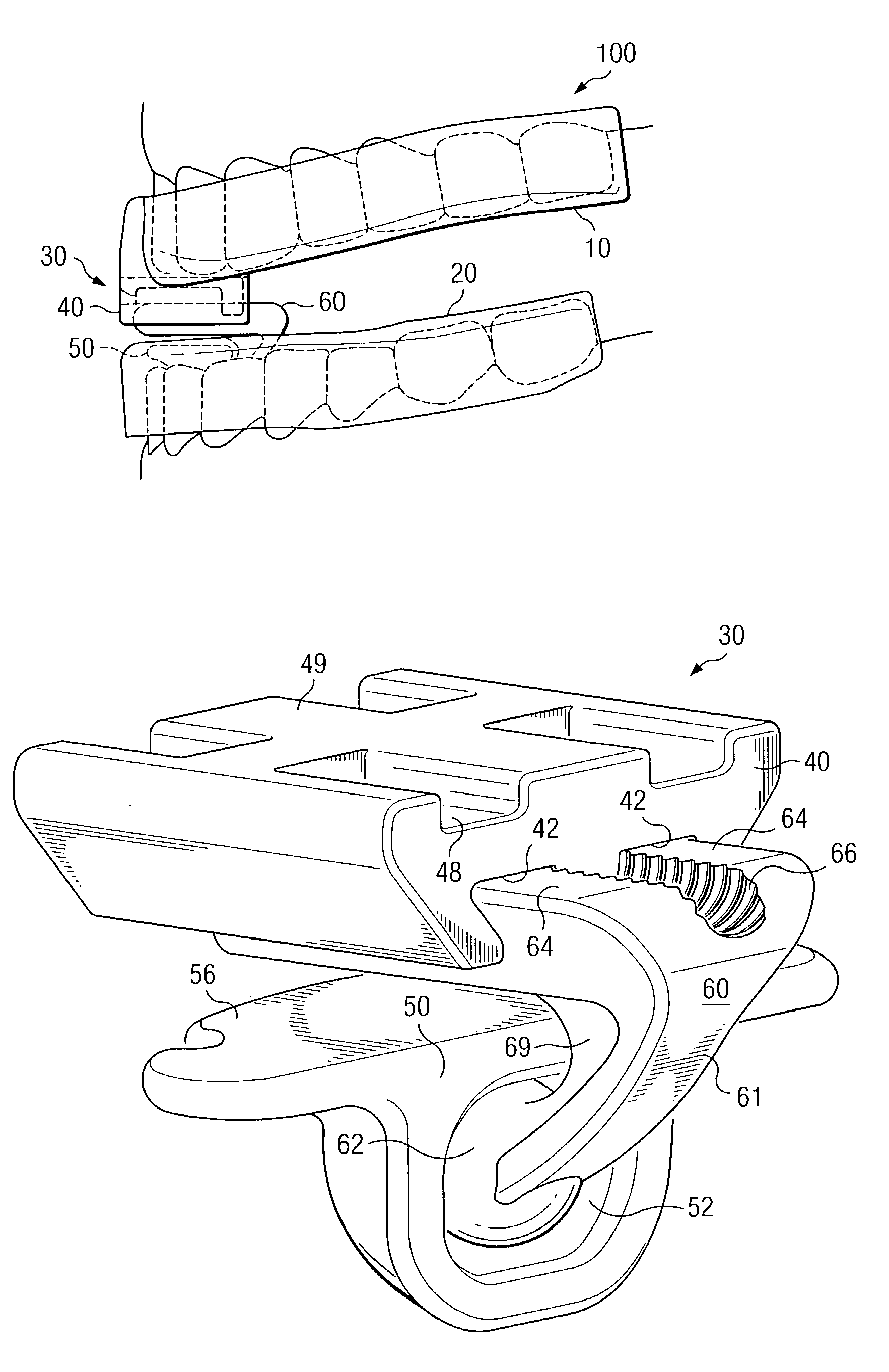 Device and method for improving a user's breathing