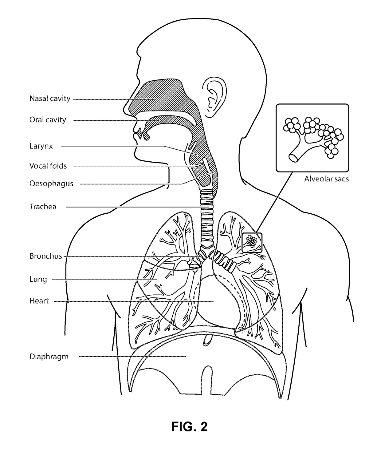 Respiratory therapy apparatus and method