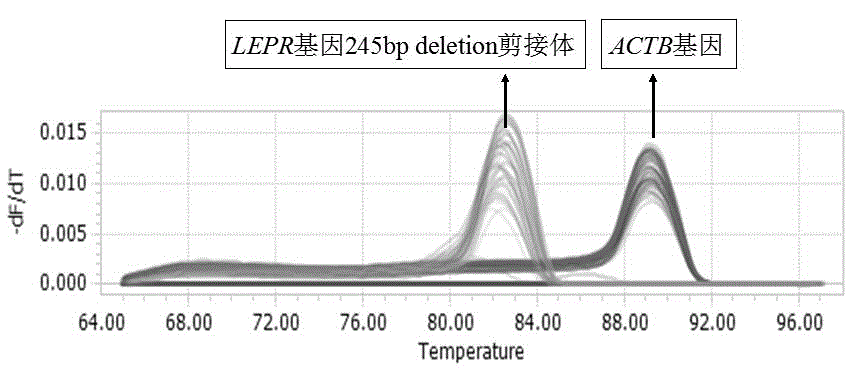 Primer, kit and detection method for detecting 245bp deletion alternative spliceosome of LEPR gene