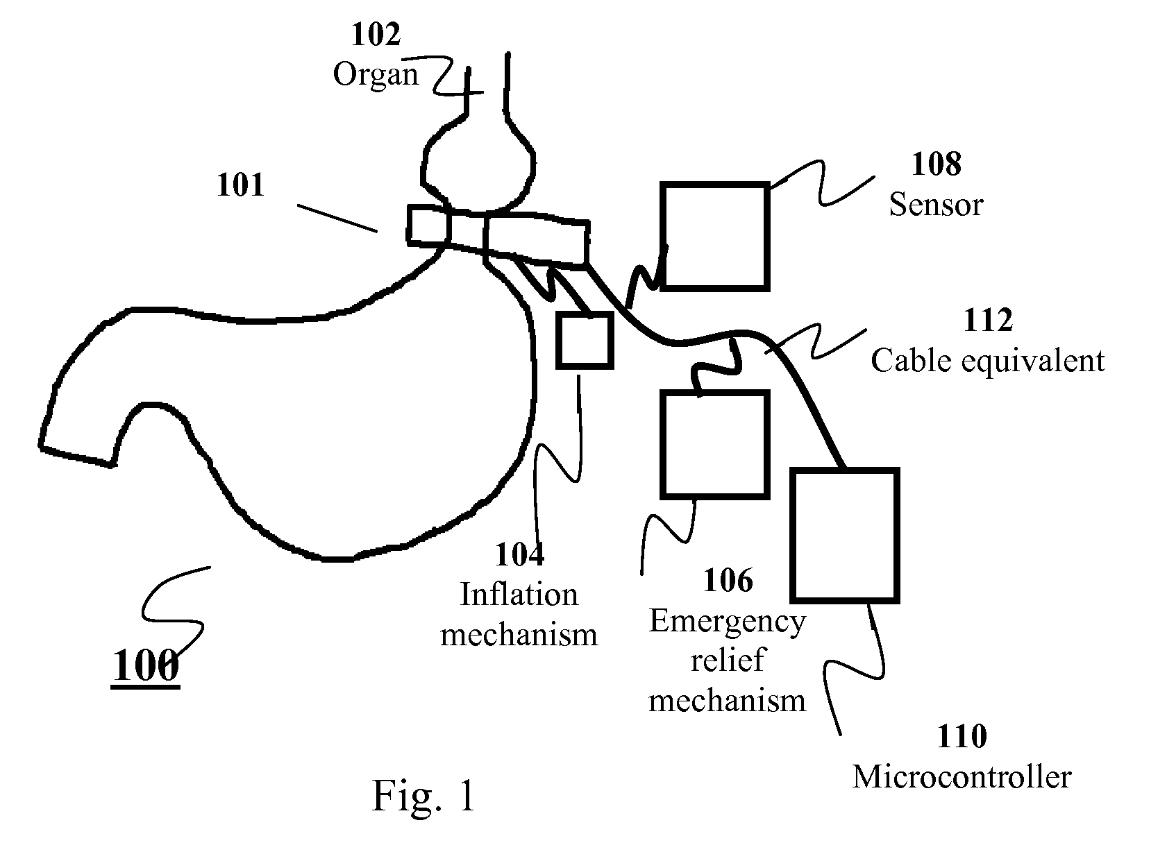 Apparatus and methods for corrective guidance of eating behavior after weight loss surgery