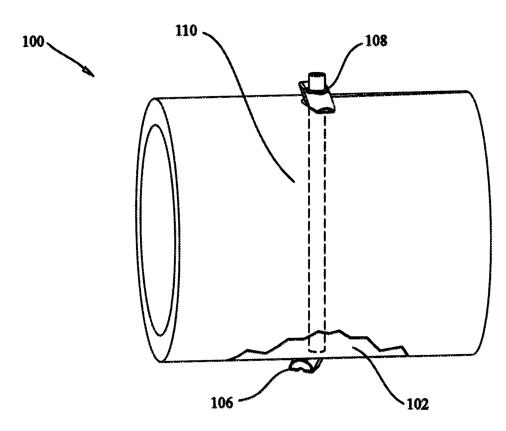 Tissue fixation system and method