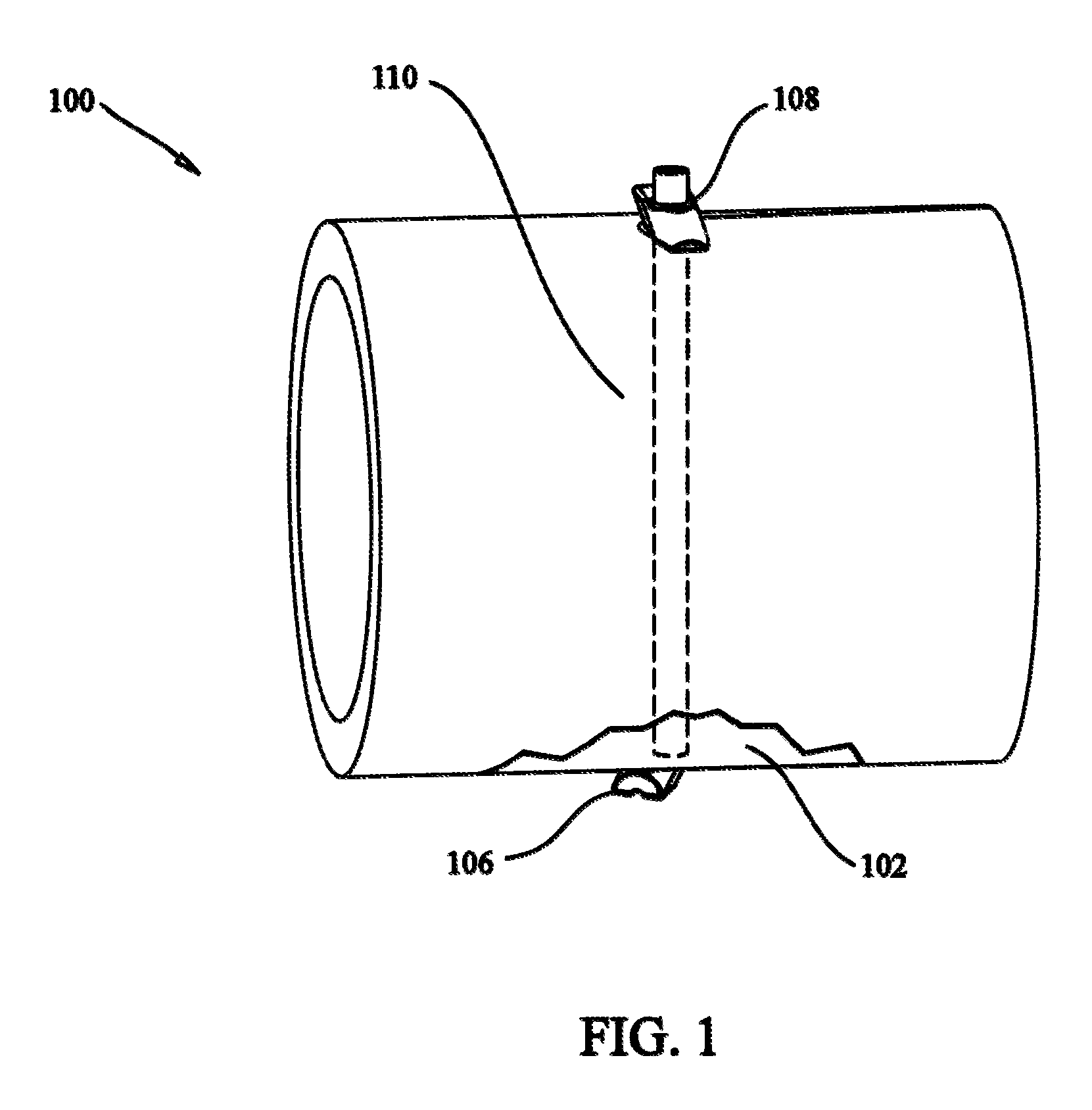 Tissue fixation system and method