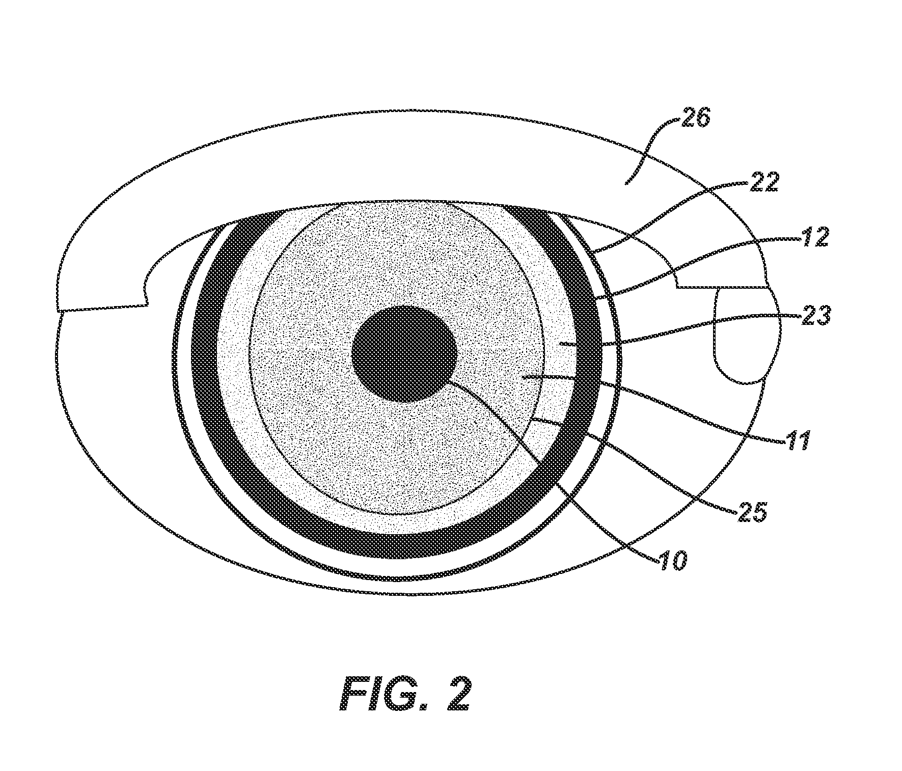 Contact Lens with Halo Effect