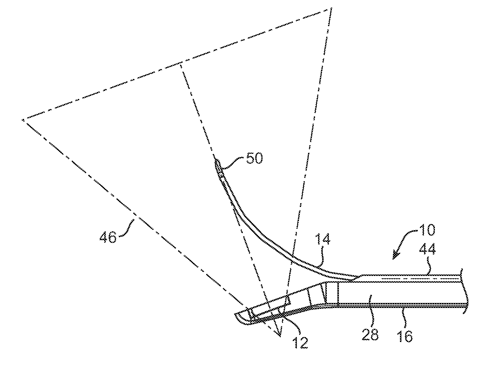 Rigid delivery systems having inclined ultrasound and curved needle