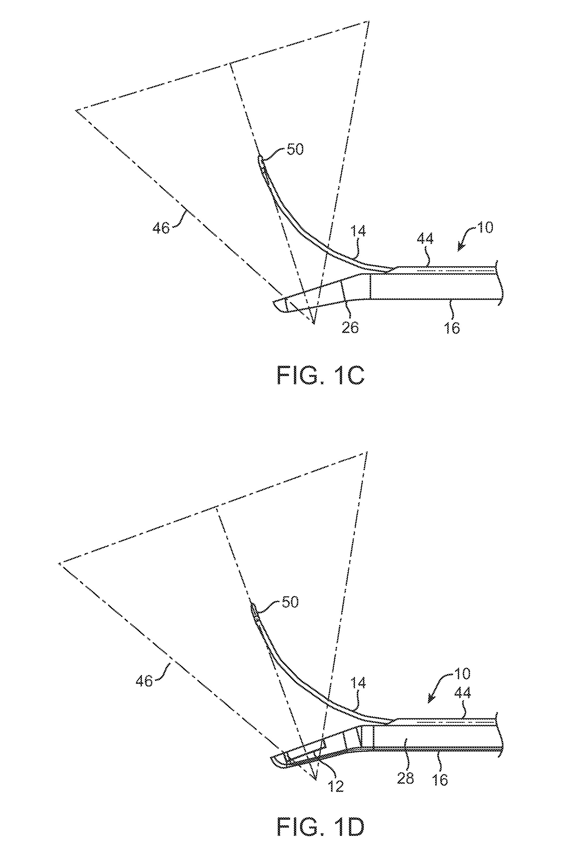 Rigid delivery systems having inclined ultrasound and curved needle