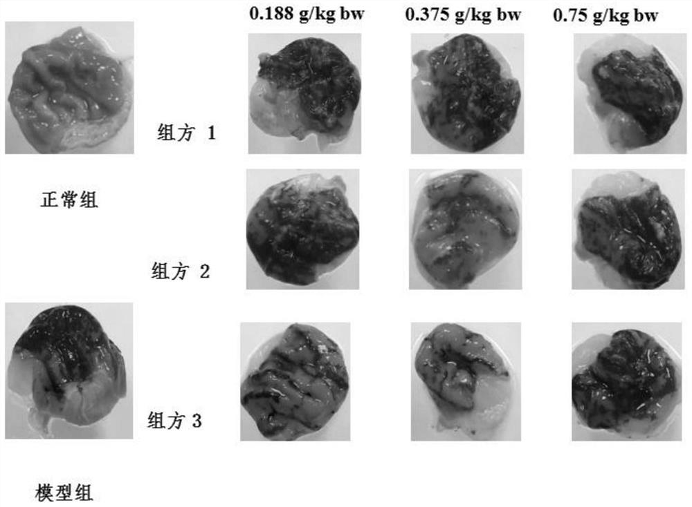 Composition with auxiliary protection effect on gastric mucosal injury and application