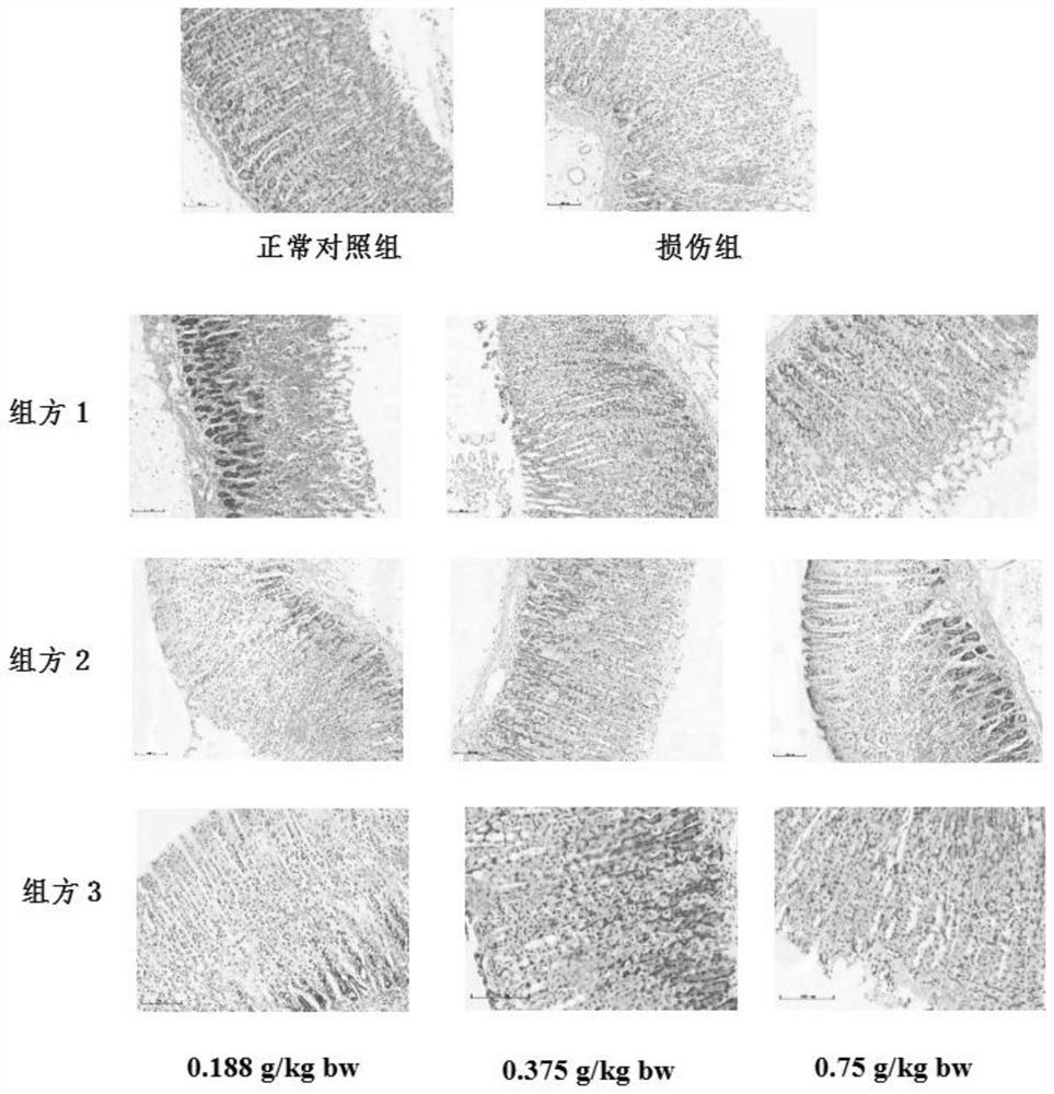 Composition with auxiliary protection effect on gastric mucosal injury and application