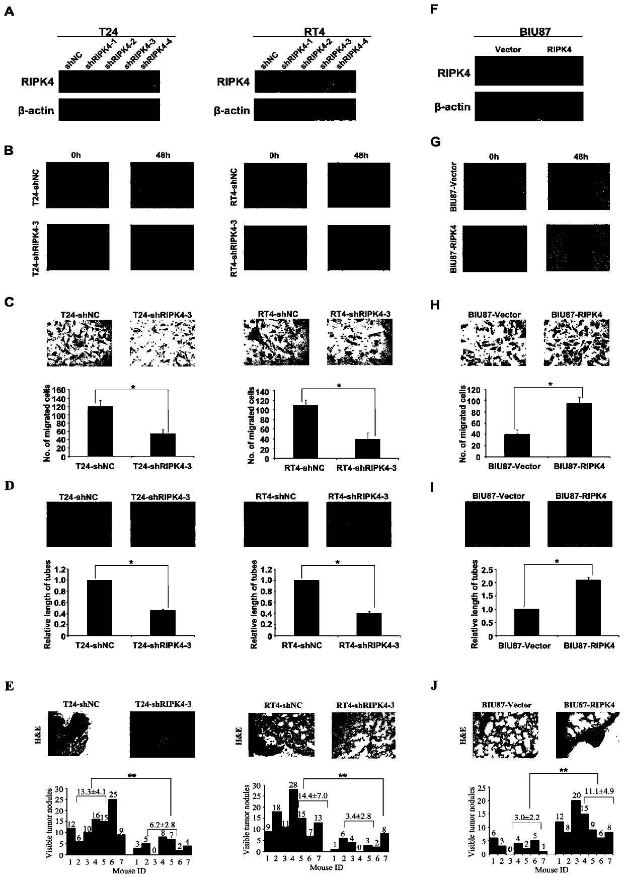 Application of ripk4 as a target site in the preparation of drugs for the treatment of bladder cancer