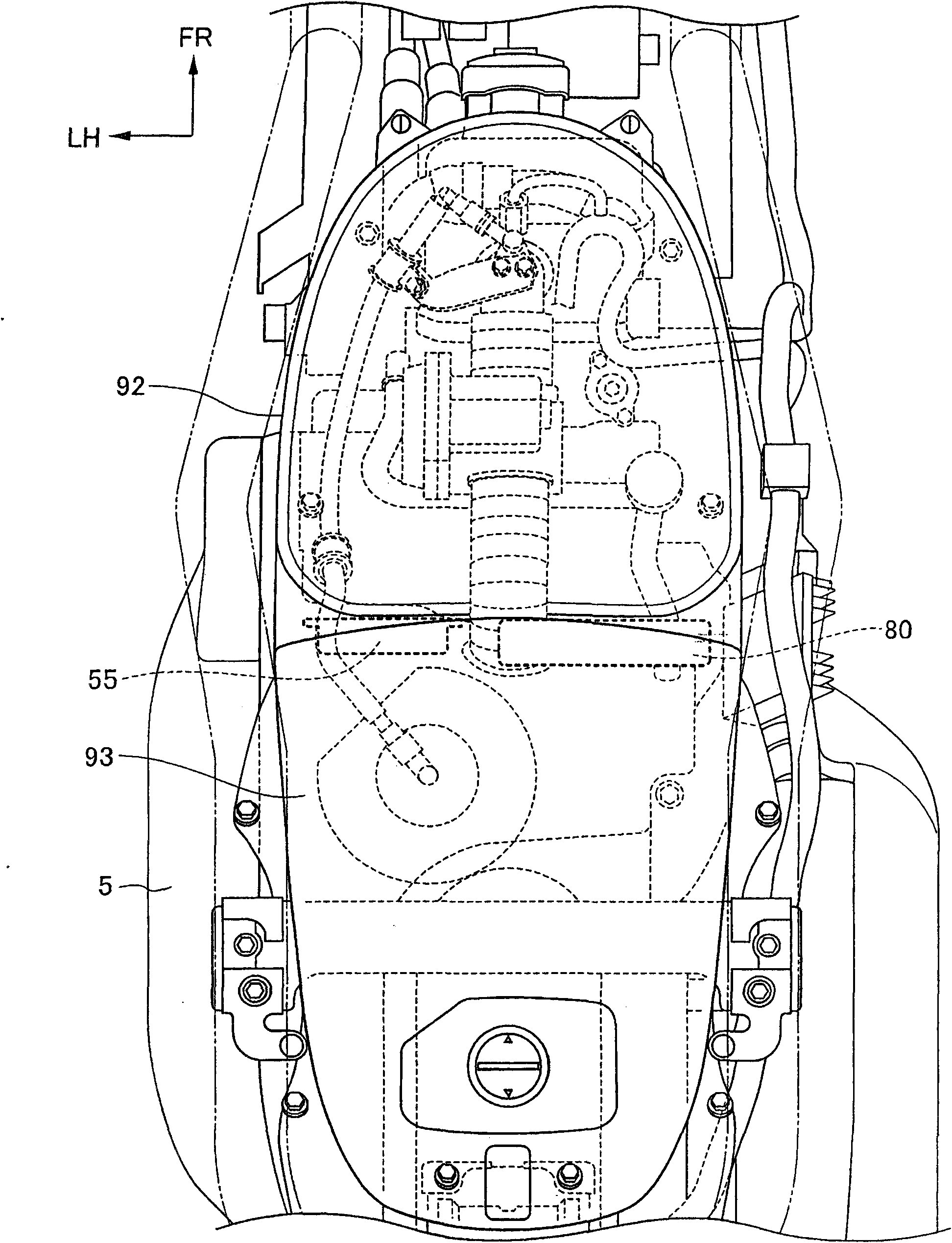 Straddle type vehicle