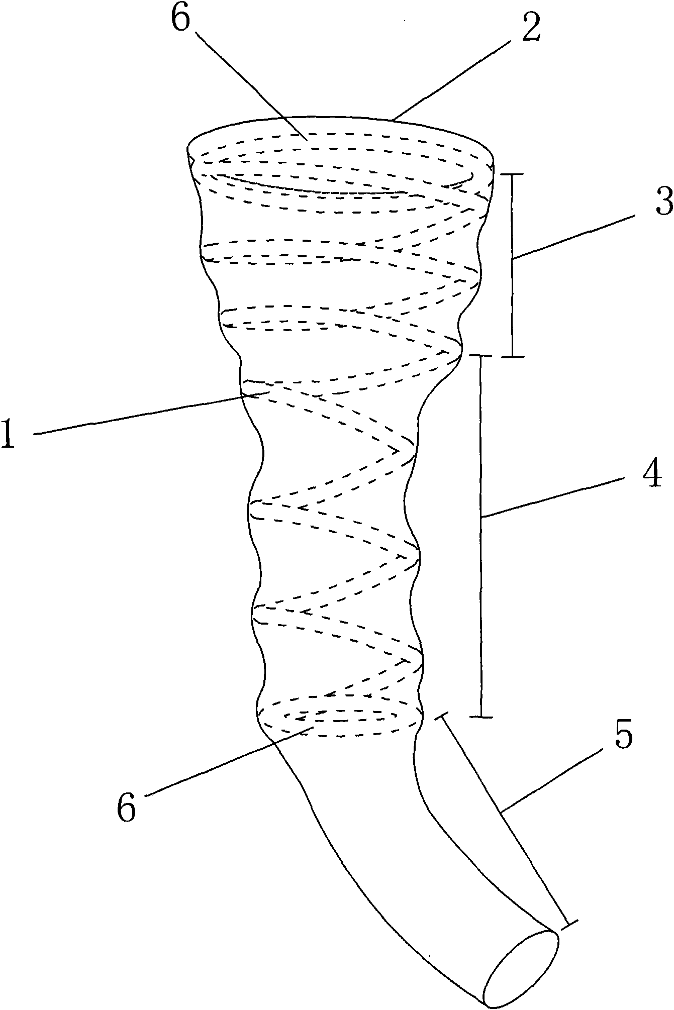 Duodenal sleeve and conveyor thereof