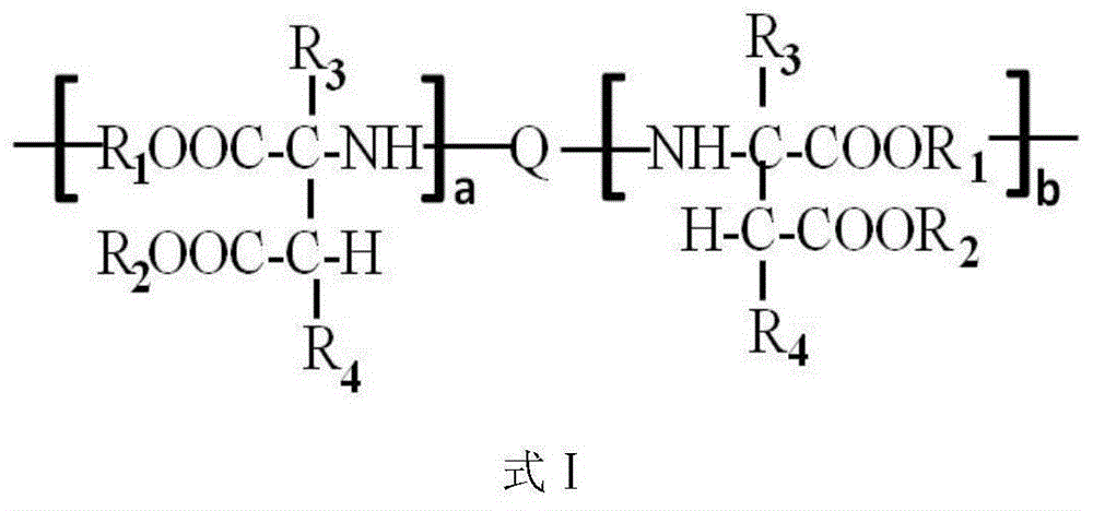 Anti-corrosion paint, application thereof and pipeline coating