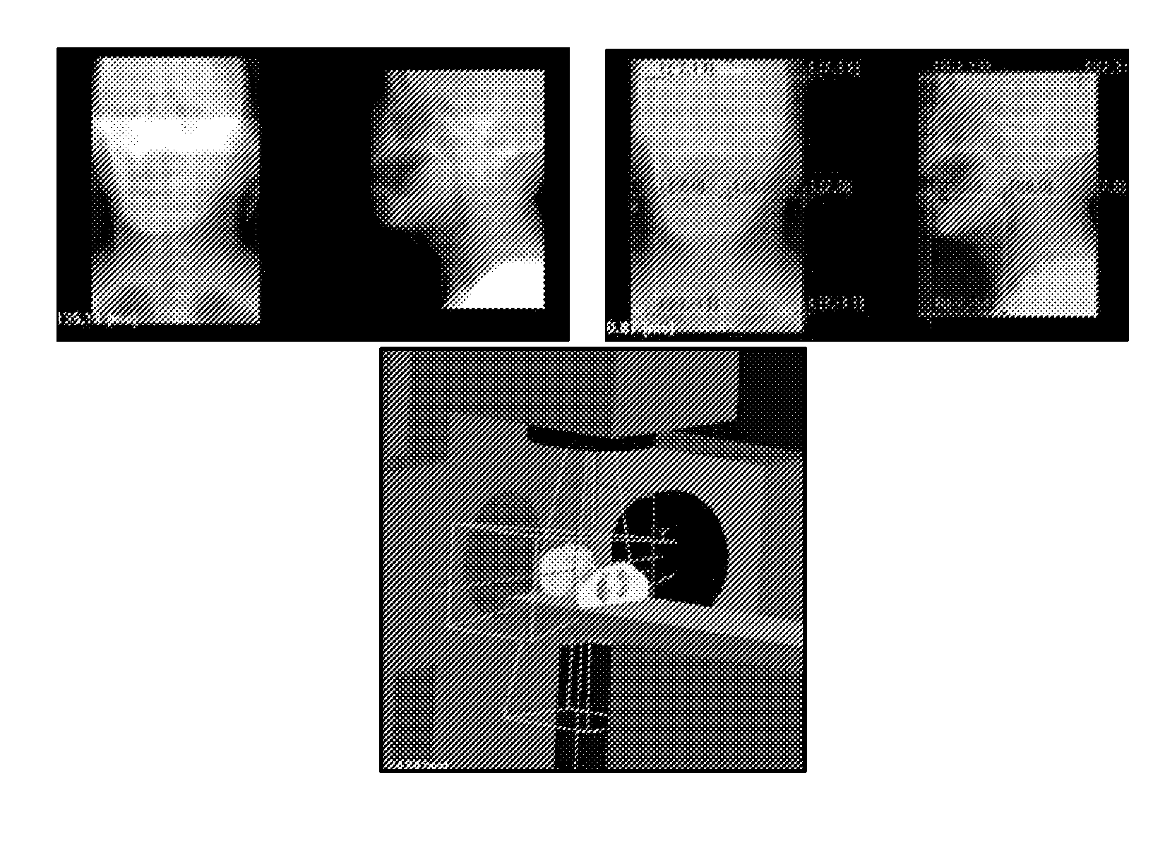 System and method for robust 2d-3d image registration