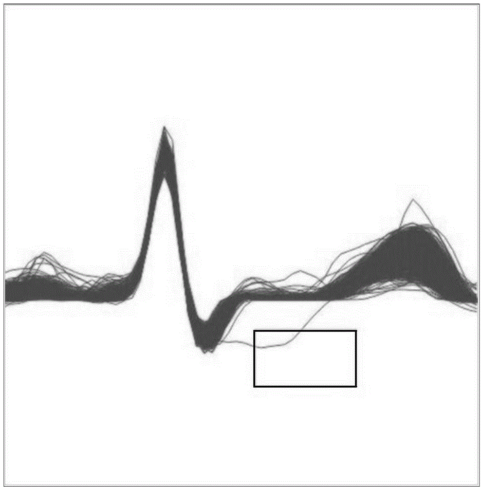 Image-based ECG analysis method and apparatus