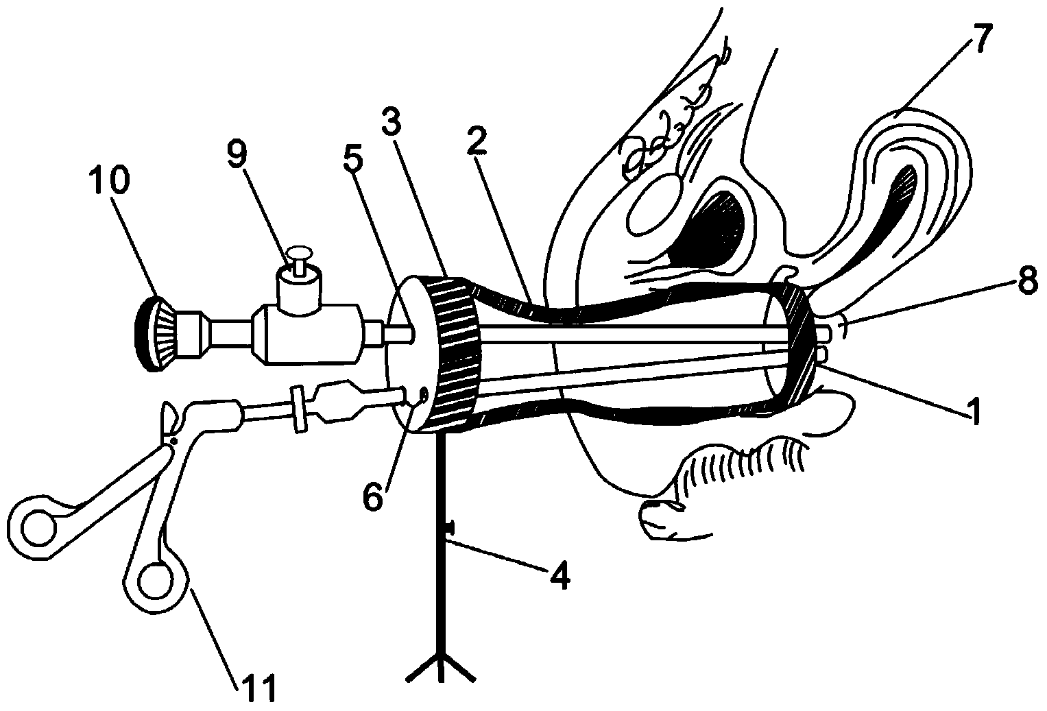 Full-vagina sleeve cylindrical expansion and pneumoperitoneum integrated device