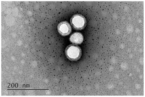 Mesenchymal stem cell membrane-coated bionic nanoparticles with overexpressed PD-L1 molecules on surface as well as preparation and application of mesenchymal stem cell membrane-coated bionic nanoparticles