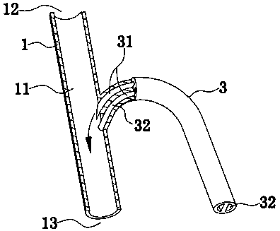 Pressure measurement urethral catheter