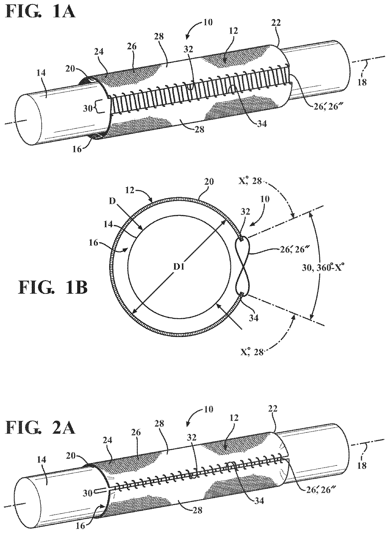 Circumferentially continuous and constrictable textile sleeve and method of construction thereof