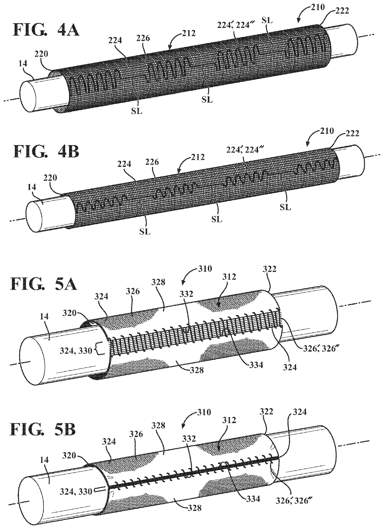 Circumferentially continuous and constrictable textile sleeve and method of construction thereof