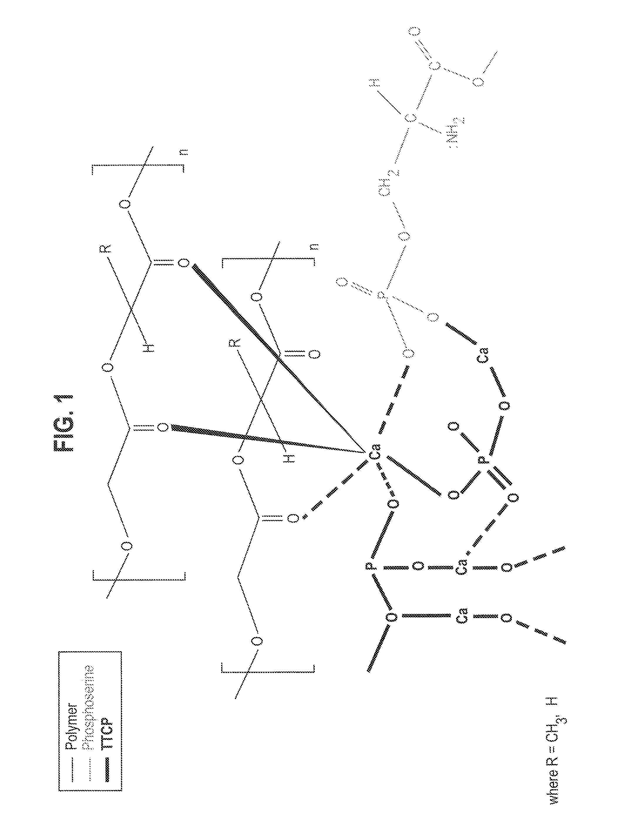 Organophosphorous, multivalent metal compounds, and polymer adhesive interpenetrating network compositions and methods