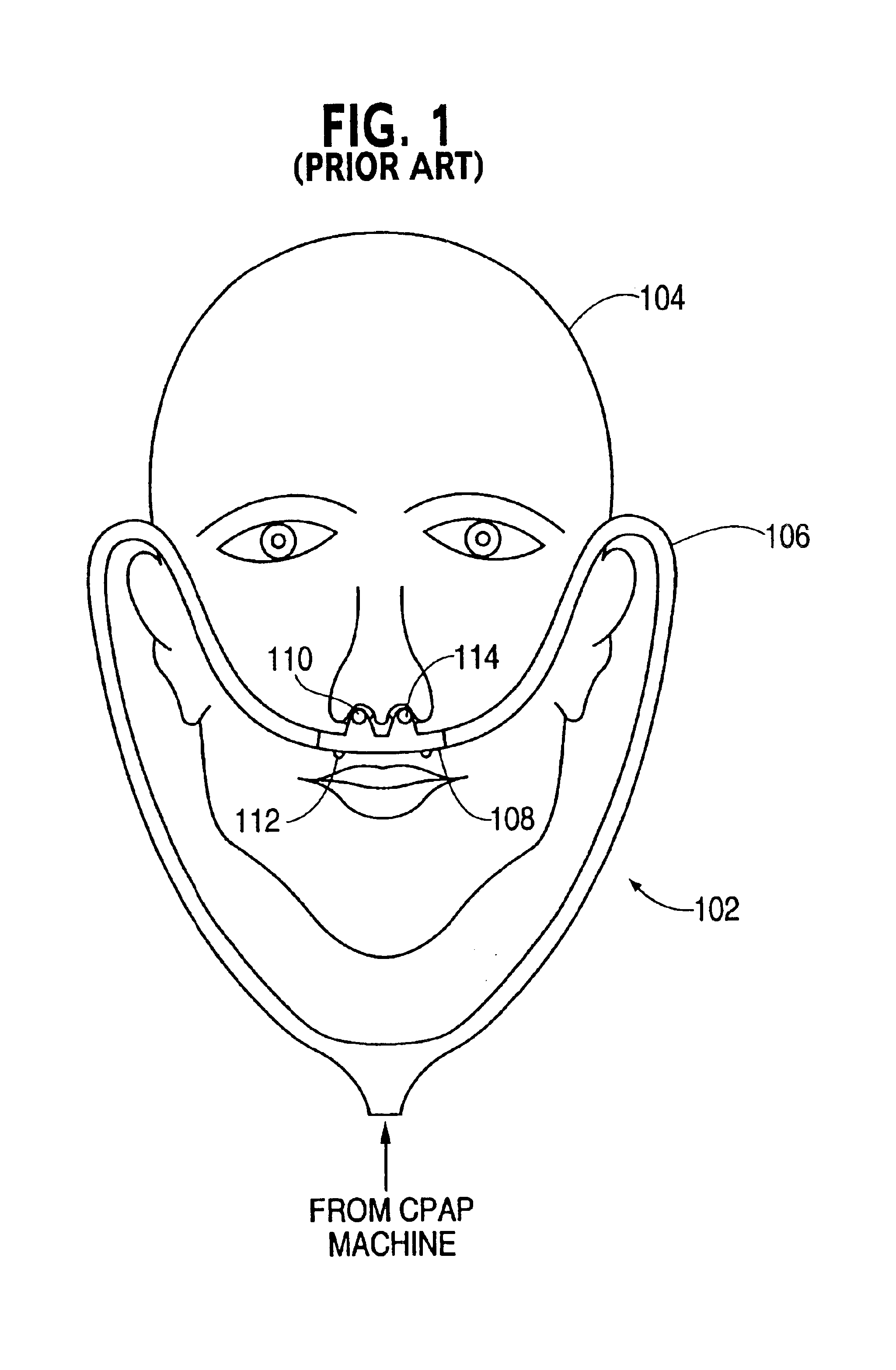 Nasal gas delivery system and method for use thereof