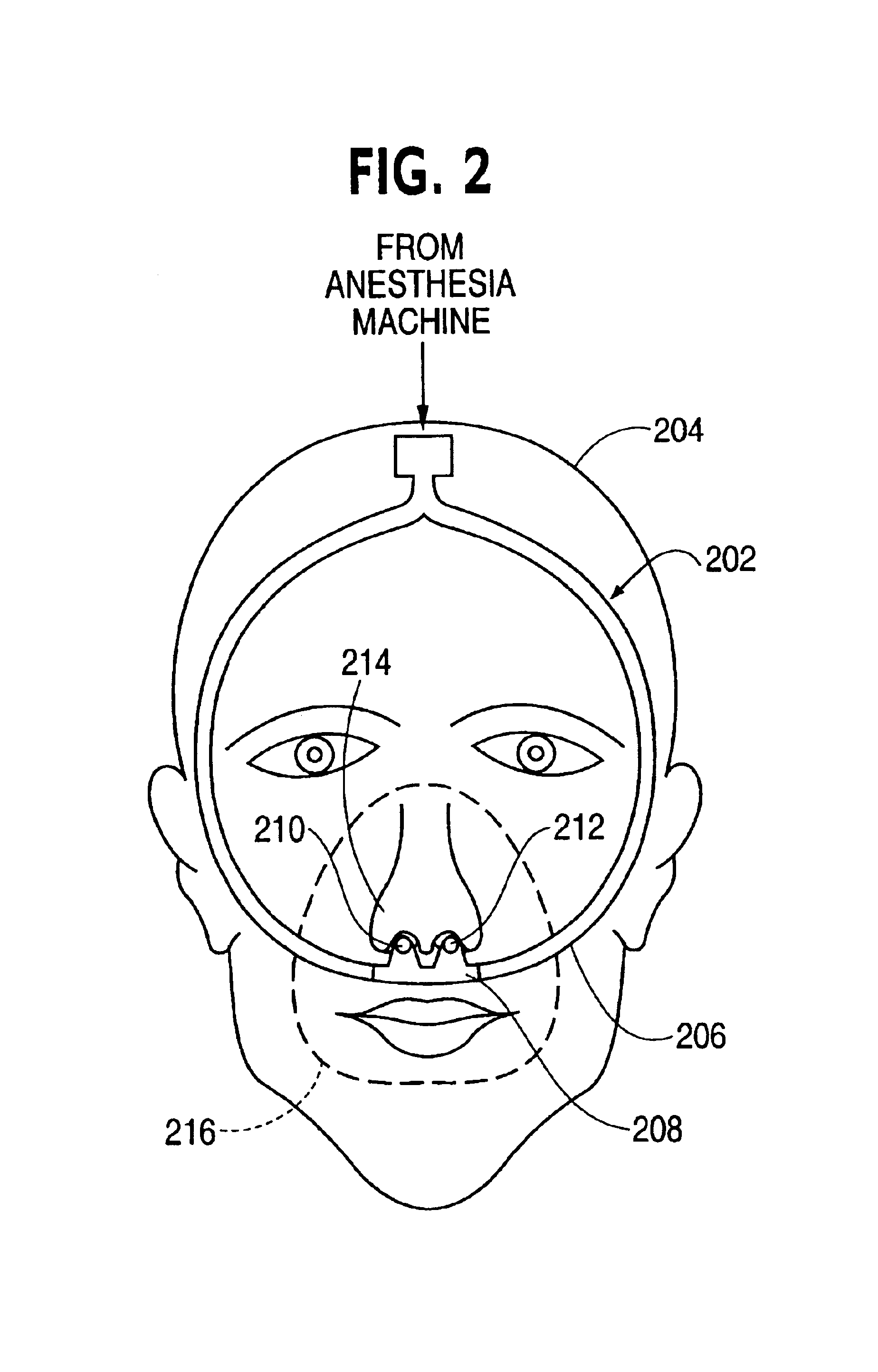 Nasal gas delivery system and method for use thereof