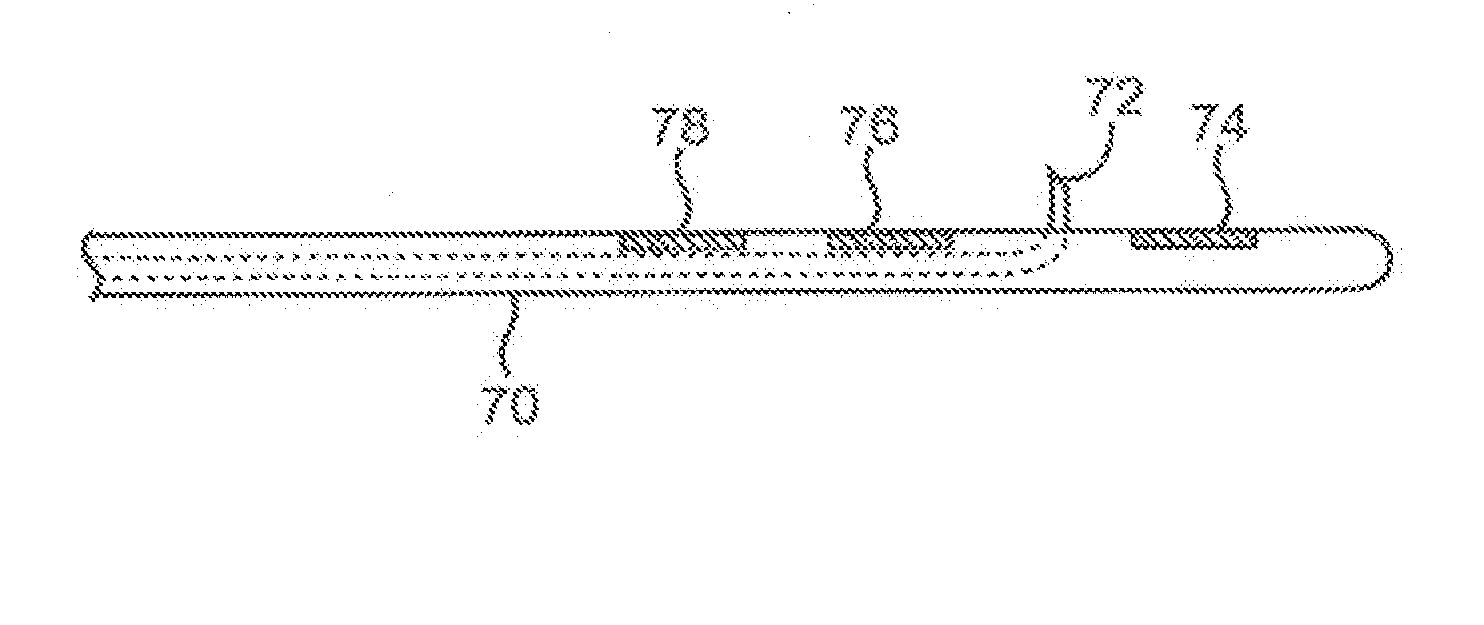 Systems and Methods for Neuromodulation for Treatment of Pain and Other Disorders Associated with Nerve Conduction