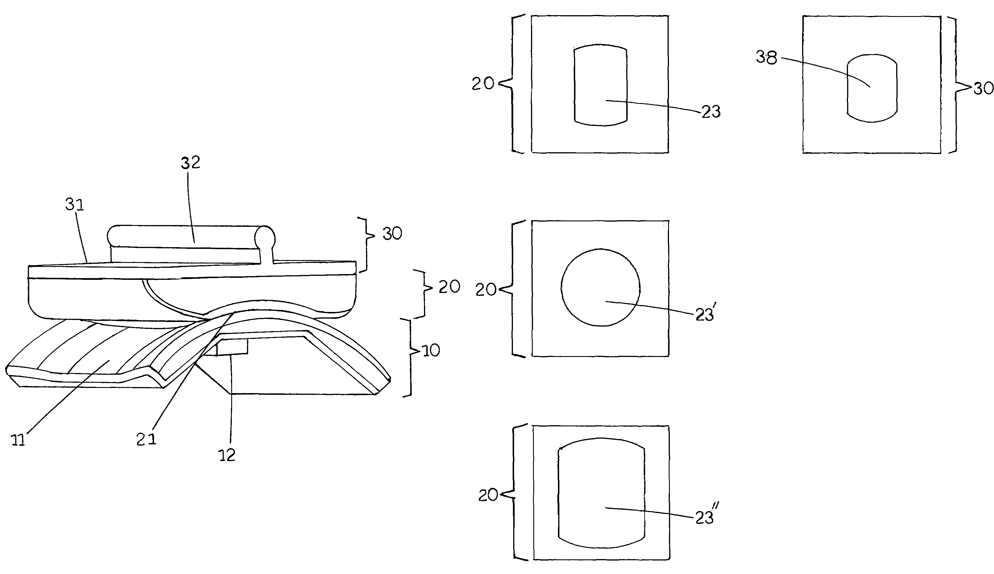 Modular total ankle prosthesis apparatuses and methods