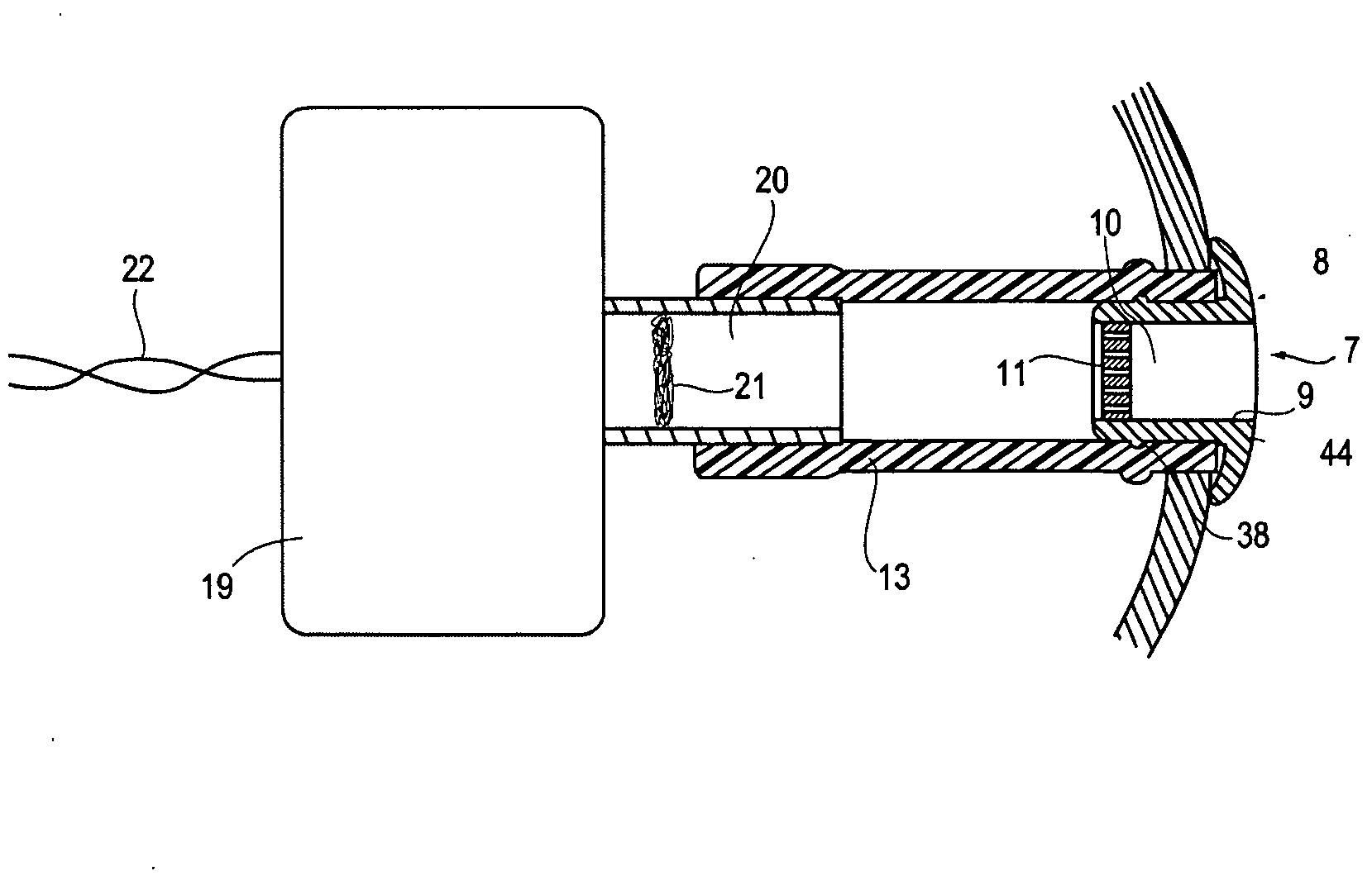 Filter for a hearing aid and a hearing aid