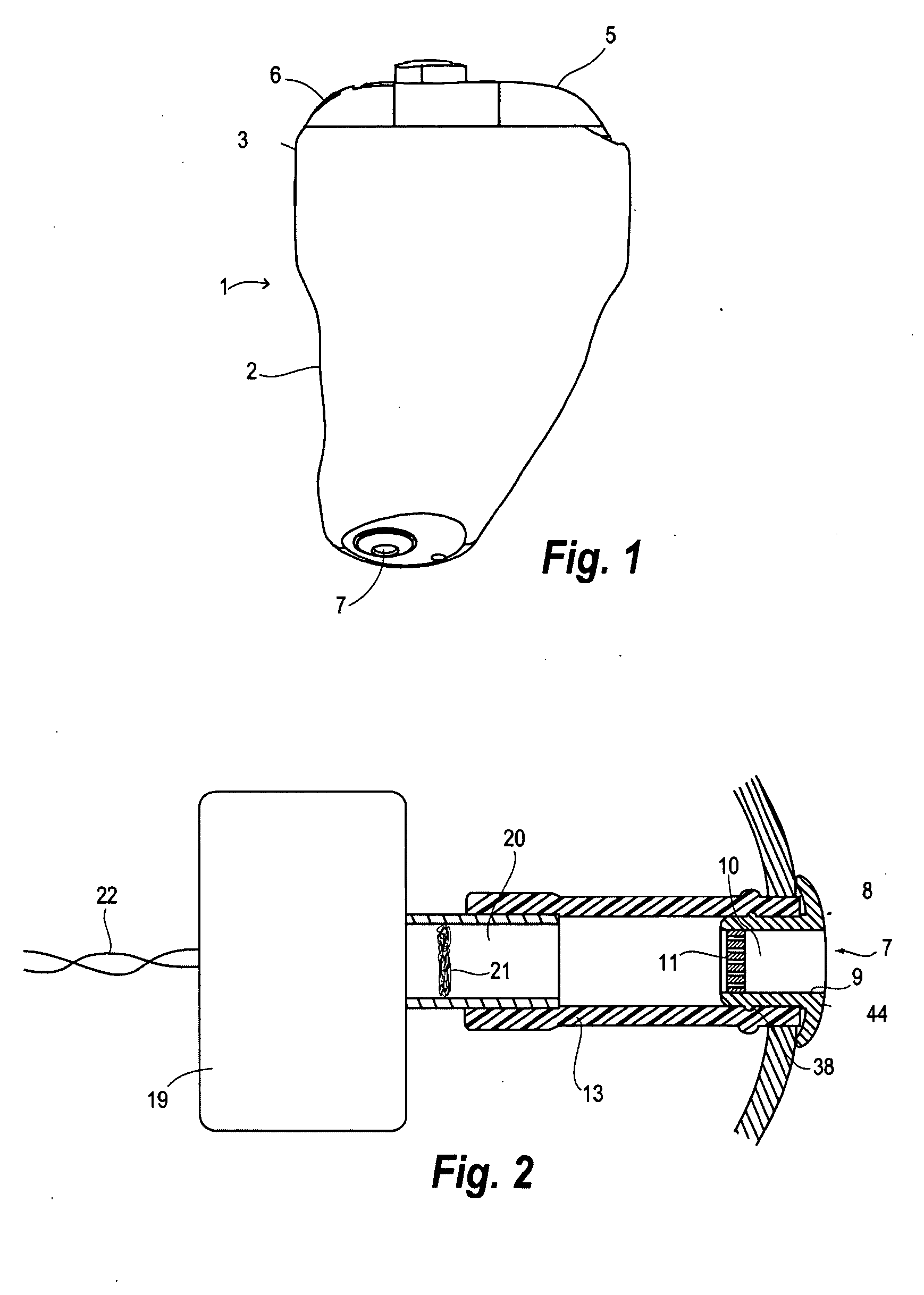 Filter for a hearing aid and a hearing aid