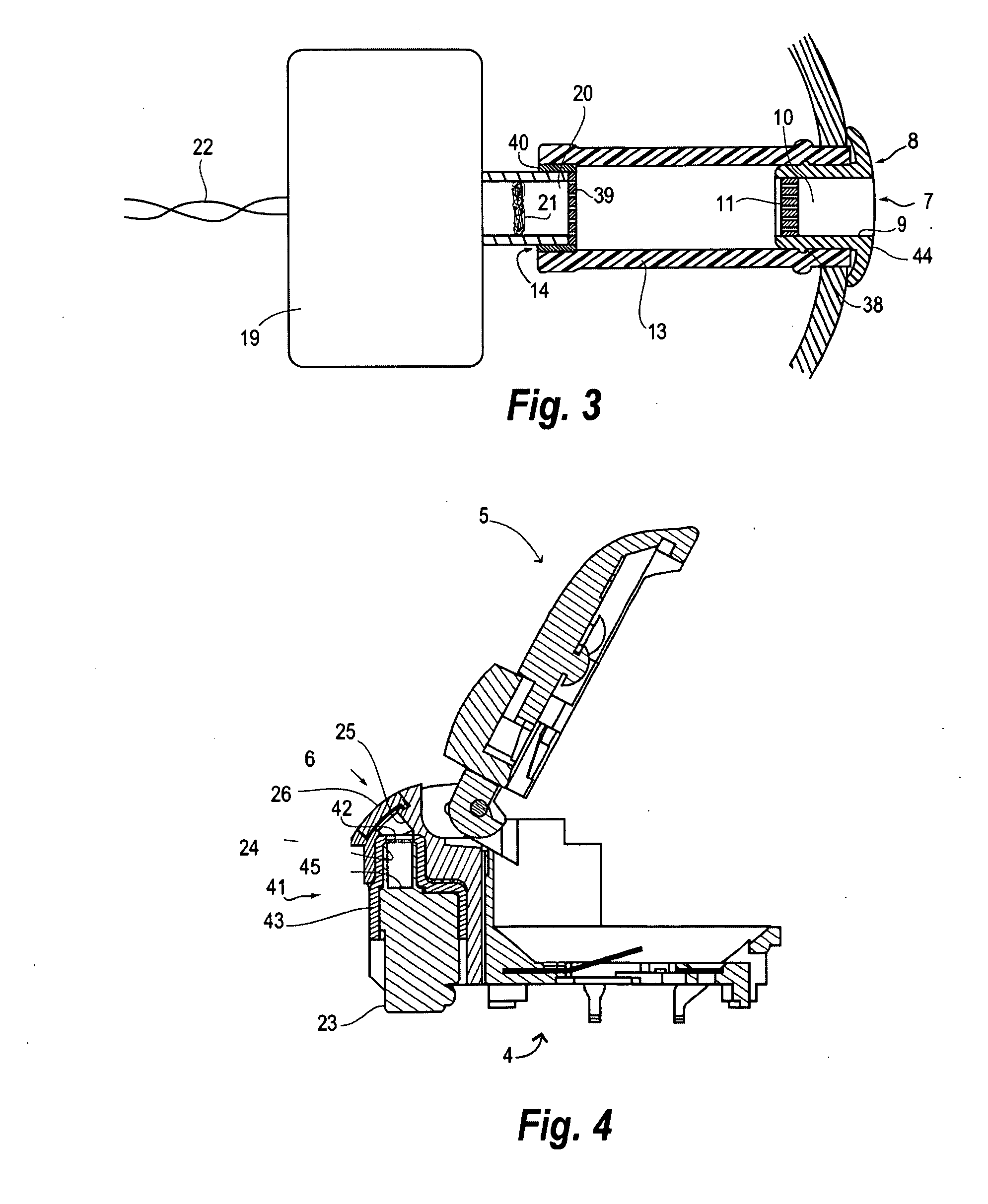 Filter for a hearing aid and a hearing aid