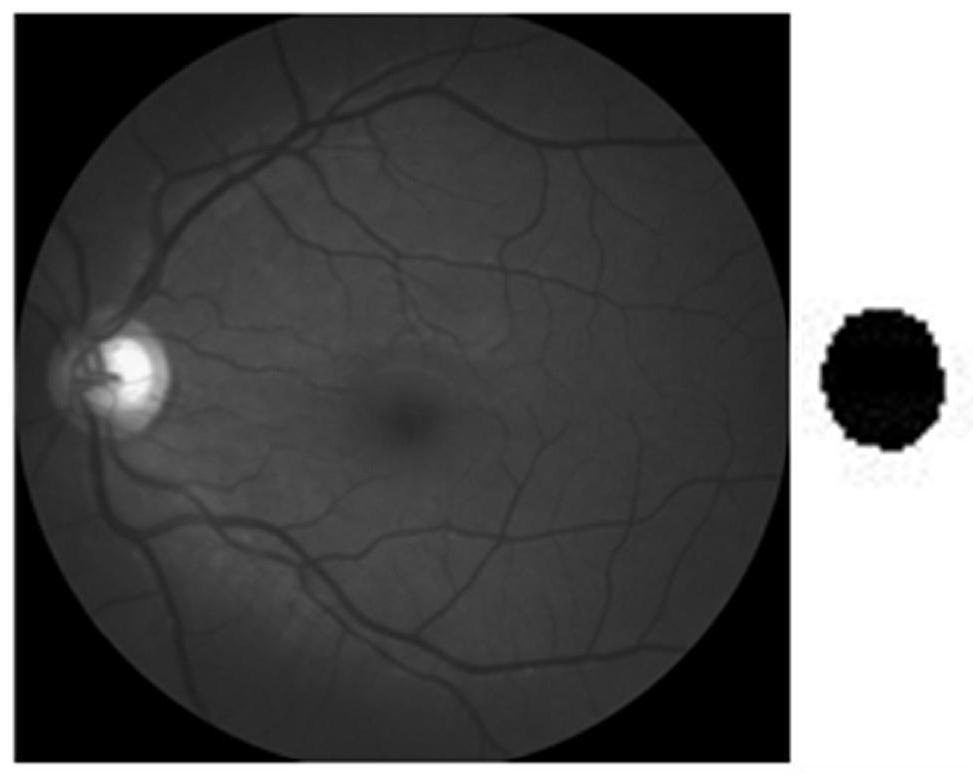 Fundus optic disc segmentation method based on U-Net neural network