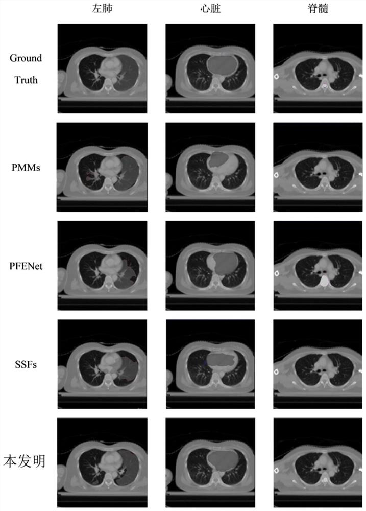 Multi-organ segmentation method based on self-supervised feature small sample learning