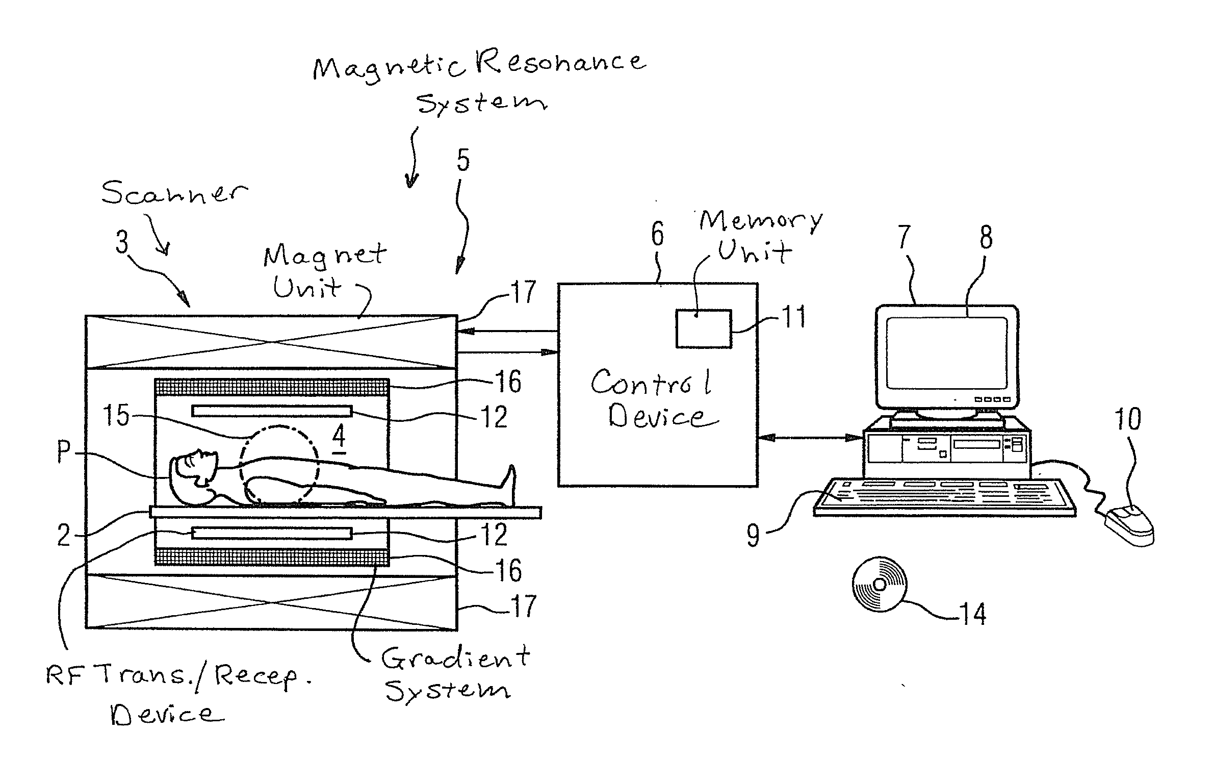 Method and magnetic resonance system to remove unwanted, perfusion-dependent signals from mr images