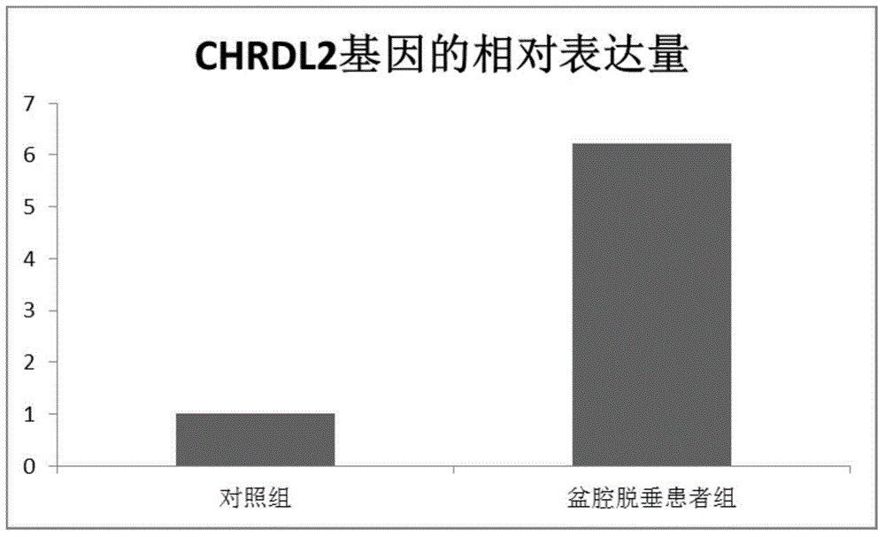 Pelvic cavity prolapse high expression gene and application thereof