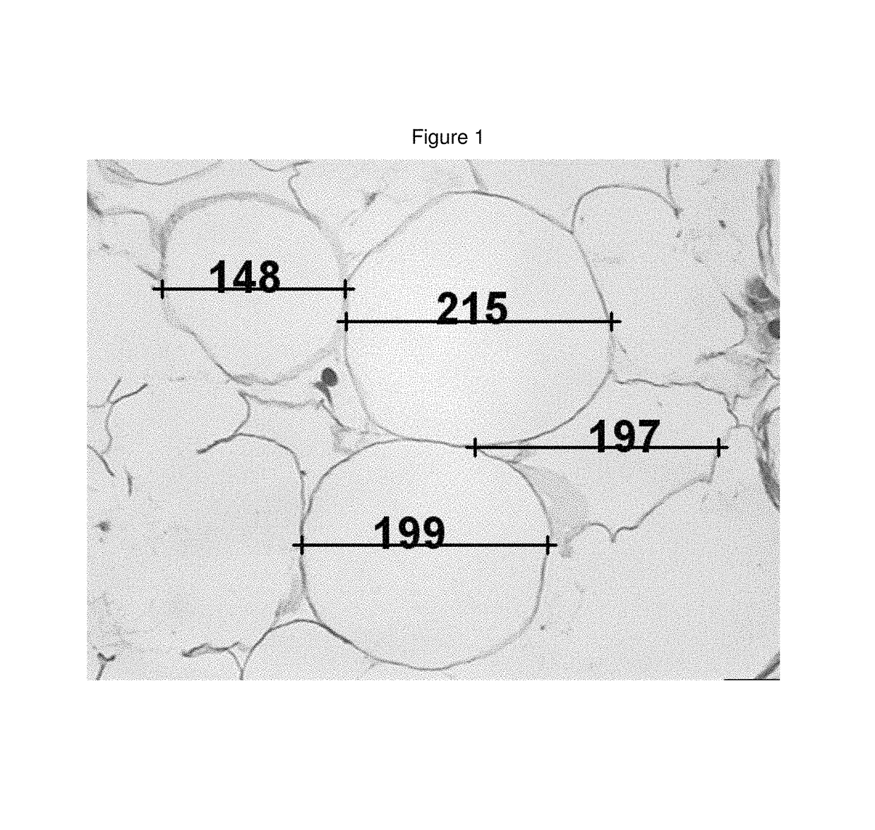 Medicinal cosmetic lipoatrophy