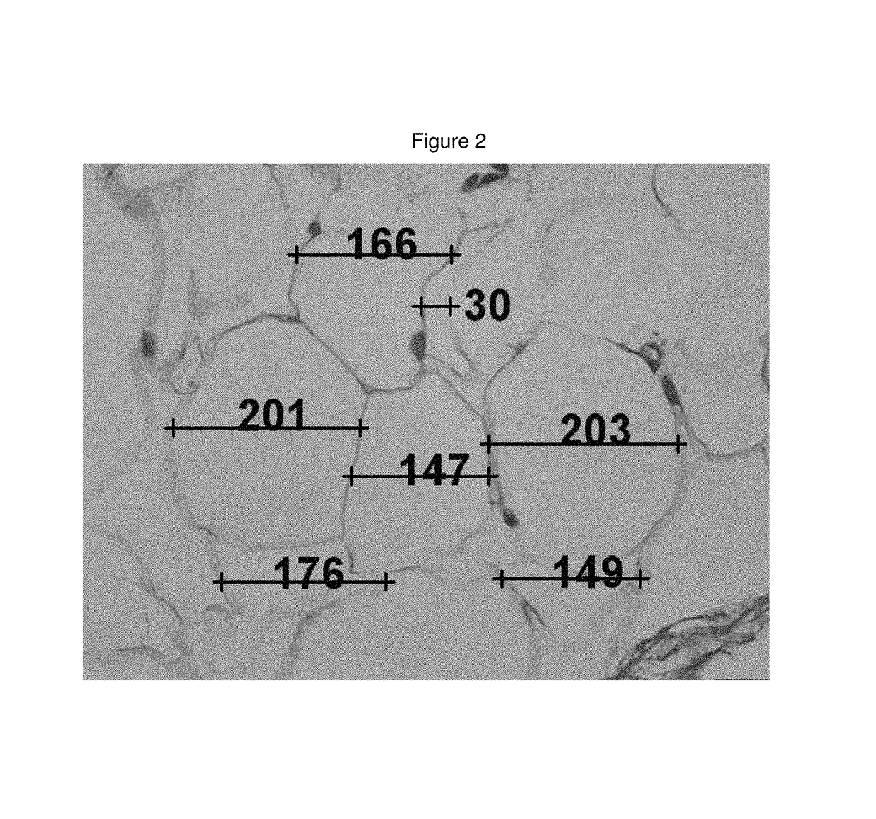 Medicinal cosmetic lipoatrophy