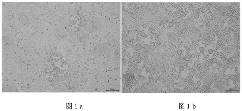 Porcine pseudorabies variant virus strain and application thereof