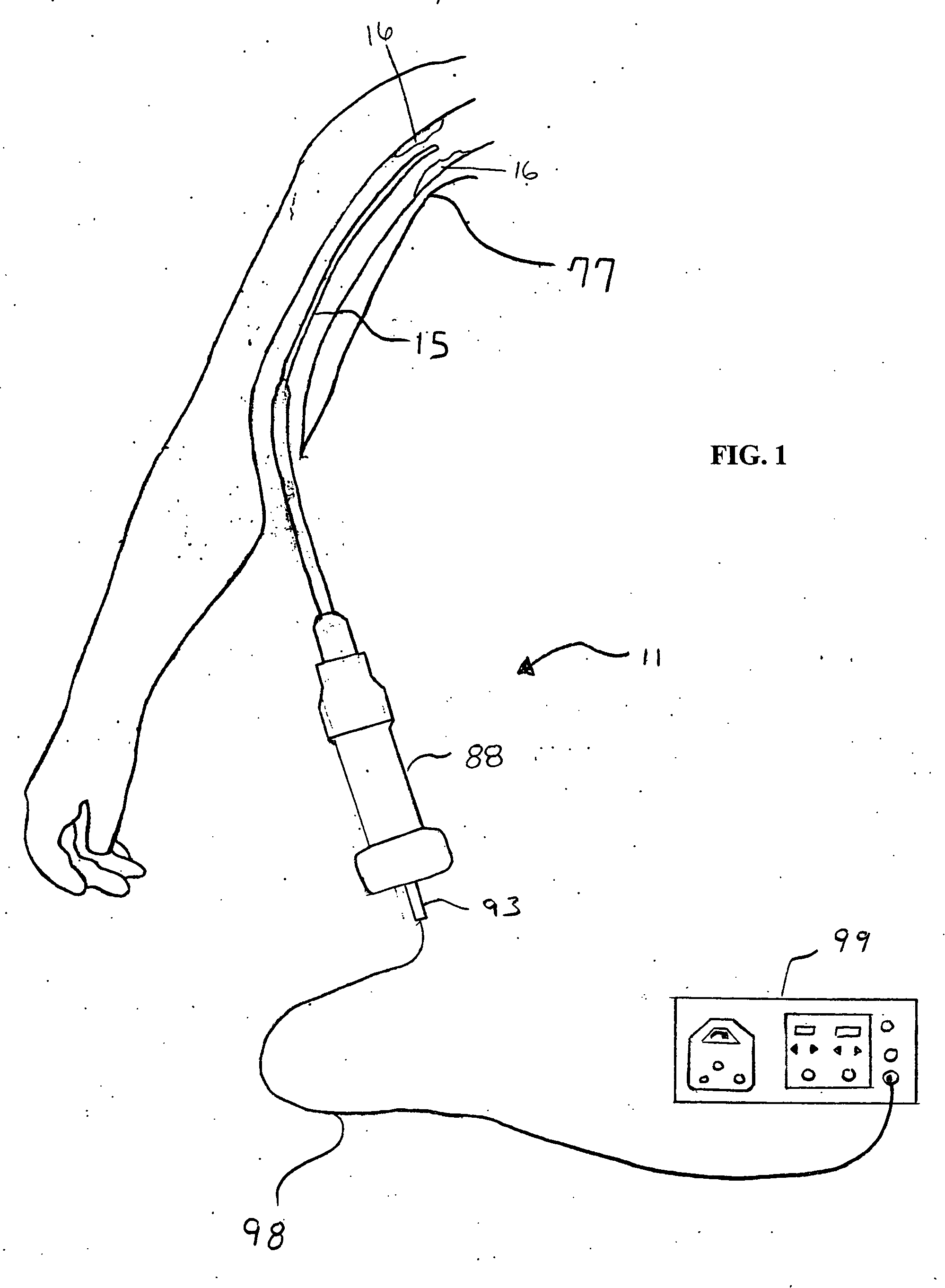 Apparatus and method for an ultrasonic medical device having a probe with a small proximal end