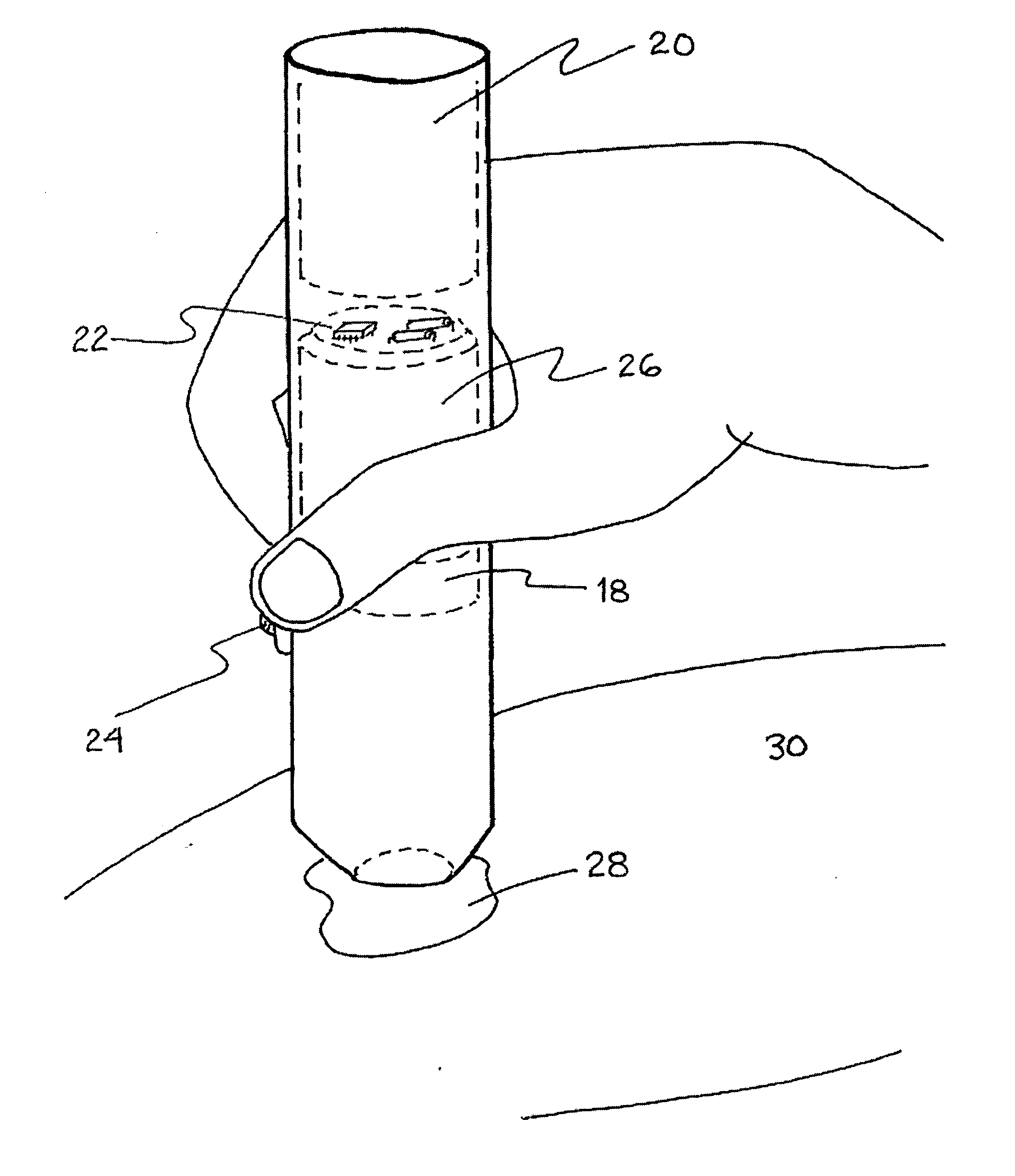 Method and apparatus for the treatment of benign pigmented lesions