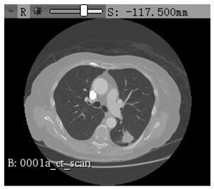 Lung CT image data segmentation method and system