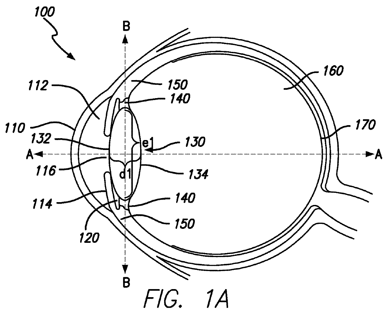 Method and system for adjusting the refractive power of an implanted intraocular lens