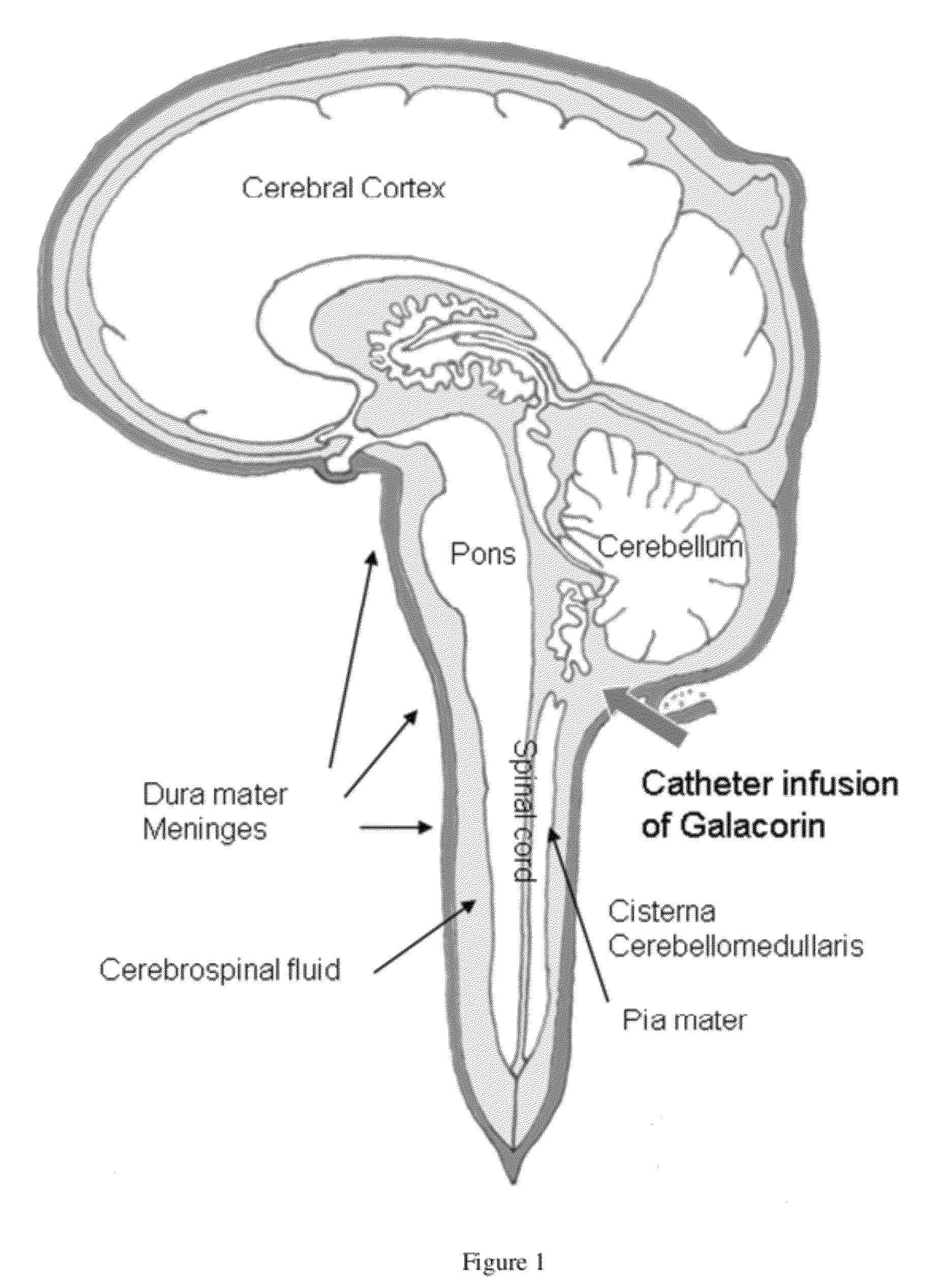 Methods for treating neurological conditions and compositions and materials therefor