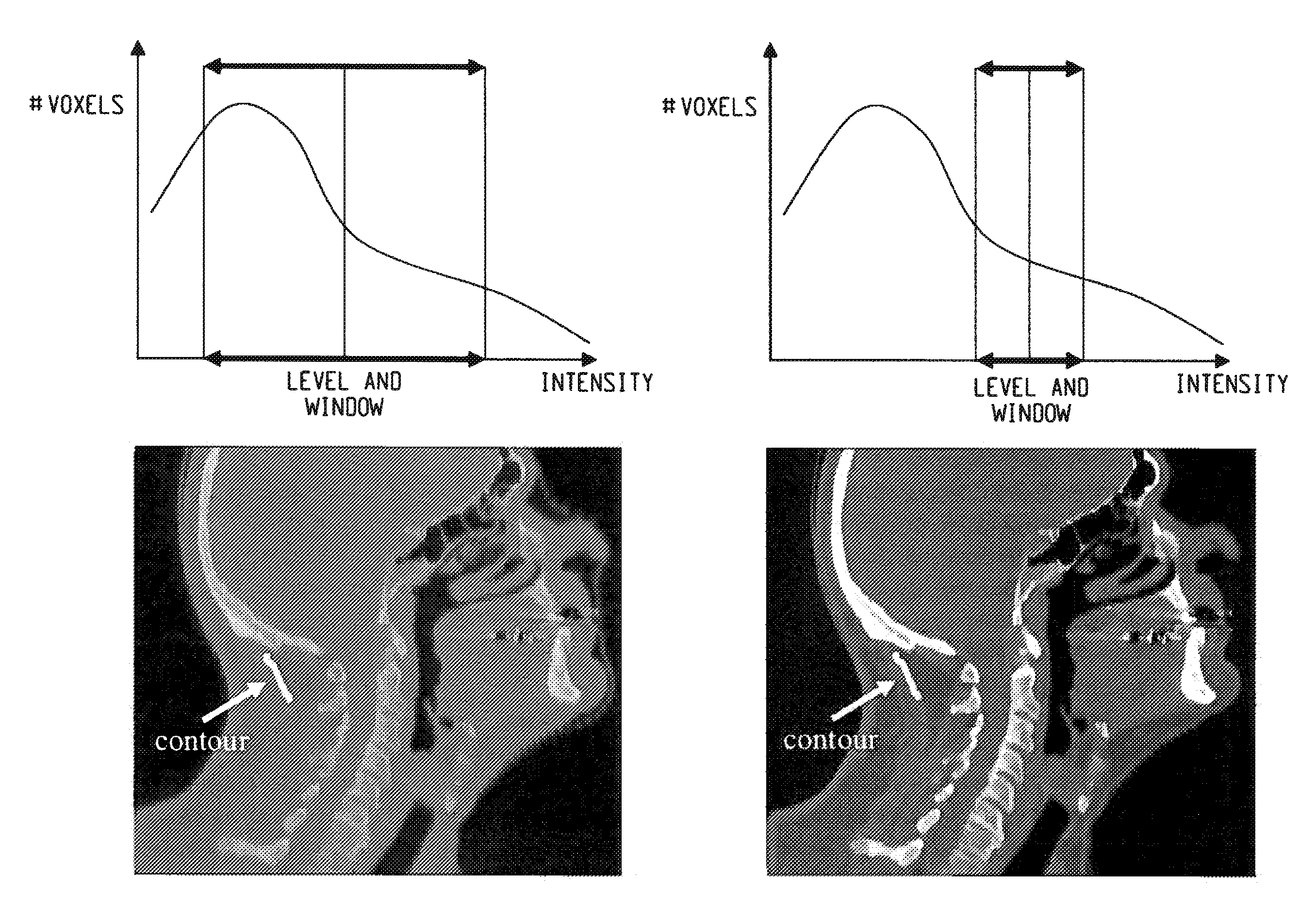 Automated contrast enhancement for contouring